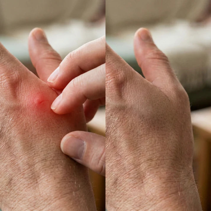 Zax's Original Itch Cream for Bug Bites, Rashes, Itching 28g